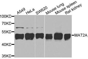 Western blot analysis of extracts of various cells, using MAT2A antibody. (MAT2A anticorps)