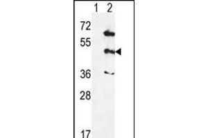 Western blot analysis of PK12 (arrow) using rabbit polyclonal hPK12- (ABIN391329 and ABIN2841359). (MAPK12 anticorps  (AA 339-367))