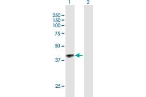 Western Blot analysis of IL12RB1 expression in transfected 293T cell line by IL12RB1 MaxPab polyclonal antibody. (IL12RB1 anticorps  (AA 1-381))