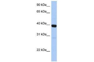ZNF385B antibody used at 0. (ZNF385B anticorps  (C-Term))