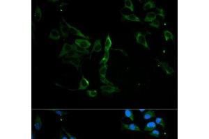 Immunofluorescence analysis of U2OS cells using MVP Polyclonal Antibody at dilution of 1:100. (MVP anticorps)