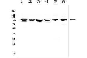Western blot analysis of DDR1 using anti-DDR1 antibody (ABIN7601407). (DDR1 anticorps  (AA 341-909))