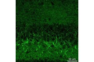 Indirect immunostaining of hippocampus neurons (dilution 1 : 500).