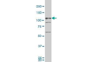 TBC1D8 monoclonal antibody (M02), clone 1A12 Western Blot analysis of TBC1D8 expression in K-562 .