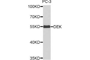 Western blot analysis of extracts of PC3 cell lines, using DEK antibody.