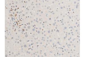 ABIN6267285 at 1/100 staining human liver tissue sections by IHC-P.