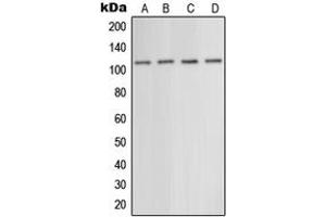 Western blot analysis of mGLUR5 expression in EOC20 (A), mouse liver (B), rat liver (C), rat brain (D) whole cell lysates. (Metabotropic Glutamate Receptor 5 anticorps  (N-Term))