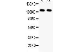 Anti- NFkB p105/p50 antibody, Western blottingAll lanes: Anti NFkB p105/p50 at 0. (NFKB1 anticorps  (N-Term))