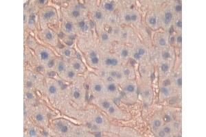 Used in DAB staining on fromalin fixed paraffin- embedded liver tissue (ABCG8 anticorps  (AA 1-272))