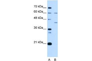 WB Suggested Anti-RFC5 Antibody Titration:  1 ug/ml  Positive Control:  Jurkat cell lysate RFC5 is strongly supported by BioGPS gene expression data to be expressed in Human Jurkat cells (RFC5 anticorps  (N-Term))