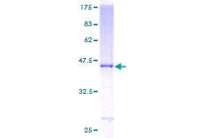 Image no. 1 for Complement Factor H (CFH) protein (GST tag) (ABIN1349206) (Complement Factor H Protein (CFH) (GST tag))