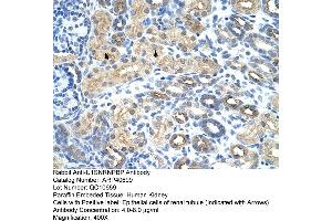 Rabbit Anti-U1SNRNPBP Antibody  Paraffin Embedded Tissue: Human Kidney Cellular Data: Epithelial cells of renal tubule Antibody Concentration: 4. (SNRNP35 anticorps  (N-Term))