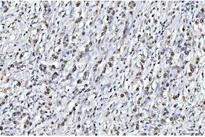 IHC analysis of PCNA using anti-PCNA antibody (ABIN7599181).