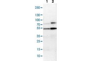 Western Blot (Cell lysate) analysis with MAPKAPK5 polyclonal antibody  Lane 1: NIH-3T3 cell lysate (Mouse embryonic fibroblast cells) Lane 2: NBT-II cell lysate (Rat Wistar bladder tumour cells) (MAPKAP Kinase 5 anticorps)