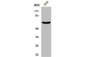 Western Blot analysis of A549 cells using MMP-11 Polyclonal Antibody (MMP11 anticorps  (Internal Region))