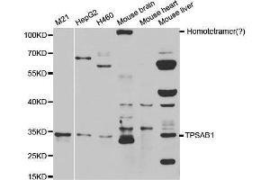 Western blot analysis of extracts of various cell lines, using TPSAB1 antibody. (TPSAB1 anticorps  (AA 19-210))
