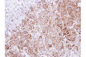 IHC-P Image Immunohistochemical analysis of paraffin-embedded SCM-1 xenograft , using HSP90B, antibody at 1:500 dilution.