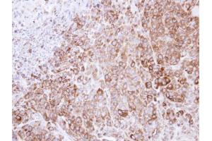 IHC-P Image Immunohistochemical analysis of paraffin-embedded SCM-1 xenograft , using HSP90B, antibody at 1:500 dilution. (GRP94 anticorps  (Center))
