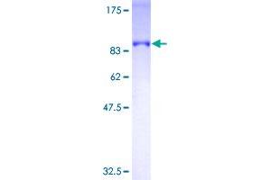 Image no. 1 for Optineurin (OPTN) (AA 1-571) protein (GST tag) (ABIN1313421)