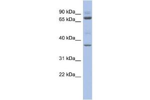 WB Suggested Anti-MTF2 Antibody Titration:  0. (MTF2 anticorps  (Middle Region))