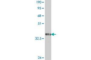 Western Blot detection against Immunogen (37 KDa) .