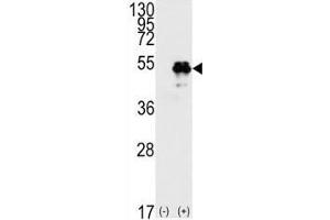 Western blot analysis of TP53 antibody and 293 cell lysate (2 ug/lane) either nontransfected (Lane 1) or transiently transfected with the TP53 gene (2).