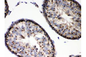 Anti- EBAG9 Picoband antibody,IHC(P) IHC(P): Rat Testis Tissue