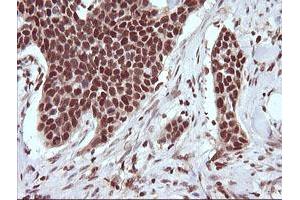 Image no. 5 for anti-Tripartite Motif Containing 38 (TRIM38) (AA 1-265) antibody (ABIN1490681) (TRIM38 anticorps  (AA 1-265))