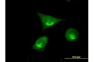 Immunofluorescence of purified MaxPab antibody to GOLGA2 on HeLa cell. (Golgin A2 (GOLGA2) (AA 1-345) anticorps)
