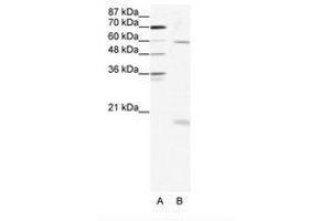 Image no. 1 for anti-SRY (Sex Determining Region Y)-Box 9 (SOX9) (AA 34-83) antibody (ABIN202687) (SOX9 anticorps  (AA 34-83))