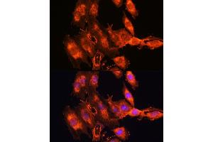Immunofluorescence analysis of C6 cells using FSTL1 antibody (ABIN7267227) at dilution of 1:100.