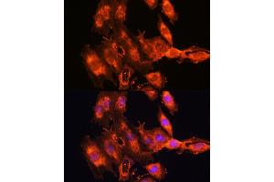 Immunofluorescence analysis of C6 cells using FSTL1 antibody (ABIN7267227) at dilution of 1:100. (FSTL1 anticorps  (AA 1-308))