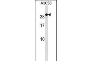 RAB7B Antibody (C-term) (ABIN1881722 and ABIN2838881) western blot analysis in  cell line lysates (35 μg/lane). (RAB7B anticorps  (C-Term))