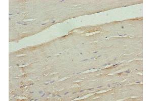 Immunohistochemistry of paraffin-embedded human skeletal muscle tissue using ABIN7175577 at dilution of 1:100 (CACNA2D1 anticorps  (AA 577-717))