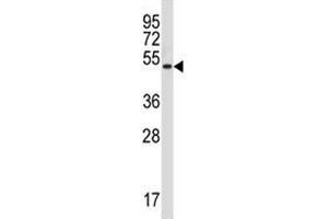 Rage antibody western blot analysis in NCI-H292 lysate. (RAGE anticorps  (AA 76-104))