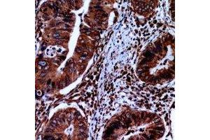 Immunohistochemical analysis of FABP2 staining in human small intestine formalin fixed paraffin embedded tissue section.