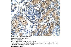 Human kidney (TIMELESS anticorps  (N-Term))