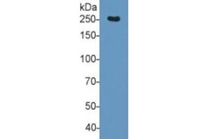 Rabbit Capture antibody from the kit in WB with Positive Control: Sample Human Serum.
