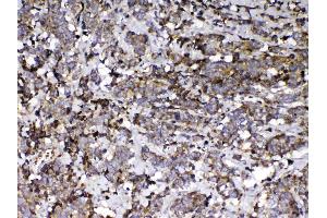 IHC analysis of Vitamin D Binding protein using anti-Vitamin D Binding protein antibody .