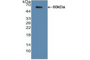 Detection of Recombinant SHMT2, Human using Polyclonal Antibody to Serine Hydroxymethyltransferase 2, Mitochondrial (SHMT2)