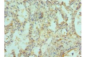 Immunohistochemistry of paraffin-embedded human lung tissue using ABIN7151217 at dilution of 1:100