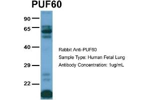 Host:  Rabbit  Target Name:  PUF60  Sample Type:  Human Fetal Lung  Antibody Dilution:  1. (PUF60 anticorps  (C-Term))