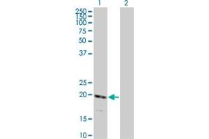 Western Blot analysis of RNF122 expression in transfected 293T cell line by RNF122 monoclonal antibody (M01), clone 5E5. (RNF122 anticorps  (AA 61-155))
