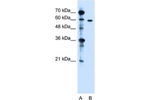 Western Blotting (WB) image for anti-Zinc Finger, DHHC-Type Containing 13 (ZDHHC13) antibody (ABIN2462814) (ZDHHC13 anticorps)