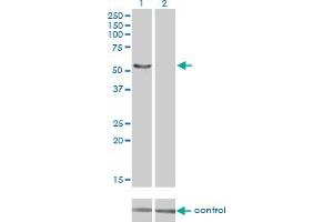 Western blot analysis of IRX6 over-expressed 293 cell line, cotransfected with IRX6 Validated Chimera RNAi (Lane 2) or non-transfected control (Lane 1). (IRX6 anticorps  (AA 337-446))
