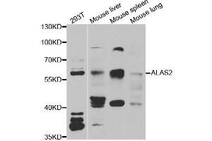 Western blot analysis of extracts of various cell lines, using ALAS2 antibody.