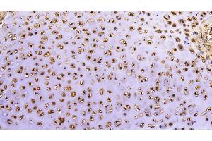 Detection of MMP13 in Porcine Lung Tissue using Polyclonal Antibody to Matrix Metalloproteinase 13 (MMP13)