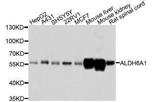 Western blot analysis of extracts of various cell lines, using ALDH6A1 antibody. (ALDH6A1 anticorps  (AA 326-535))