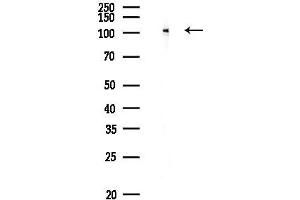 anti-SFRS Protein Kinase 2 (SRPK2) (pSer494), (pSer497) antibody
