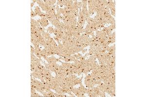(ABIN6244226 and ABIN6577745) staining WDR82 in human brain tissue sections by Immunohistochemistry (IHC-P - paraformaldehyde-fixed, paraffin-embedded sections).